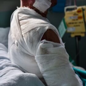 Proving Negligence in Florida Personal Injury Cases Common Questions