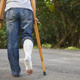 Comprehensive Guide to Pain and Suffering Damages in Florida Personal Injury Cases